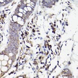 Immunohistochemistry - Anti-IL-6R Antibody (A8941) - Antibodies.com