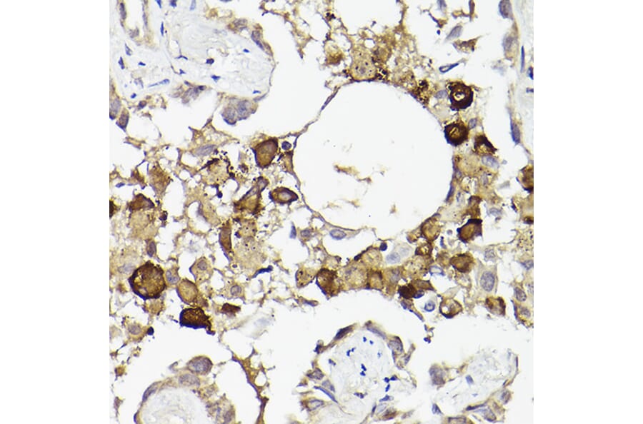 Immunohistochemistry - Anti-IL-6R Antibody (A8941) - Antibodies.com