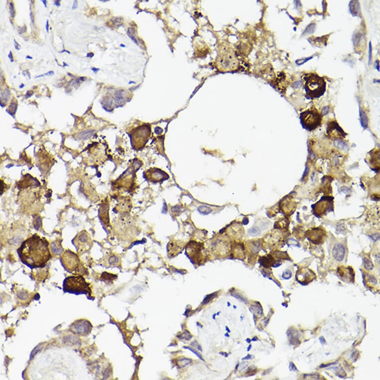 Immunohistochemistry - Anti-IL-6R Antibody (A8941) - Antibodies.com