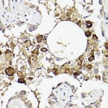 Immunohistochemistry - Anti-IL-6R Antibody (A8941) - Antibodies.com