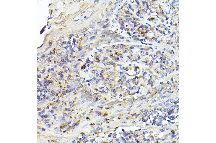 Immunohistochemistry - Anti-IL-6R Antibody (A8941) - Antibodies.com