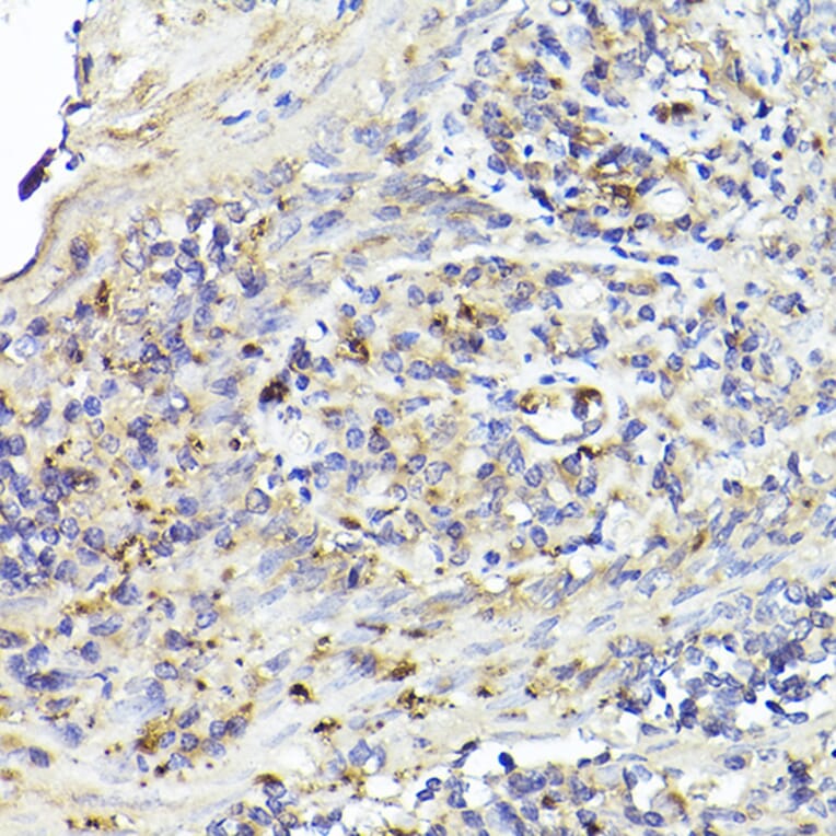 Immunohistochemistry - Anti-IL-6R Antibody (A8941) - Antibodies.com