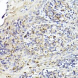 Immunohistochemistry - Anti-IL-6R Antibody (A8941) - Antibodies.com