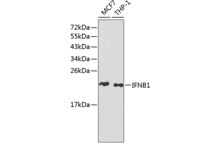Western Blot - Anti-IFNB1 Antibody (A1575) - Antibodies.com