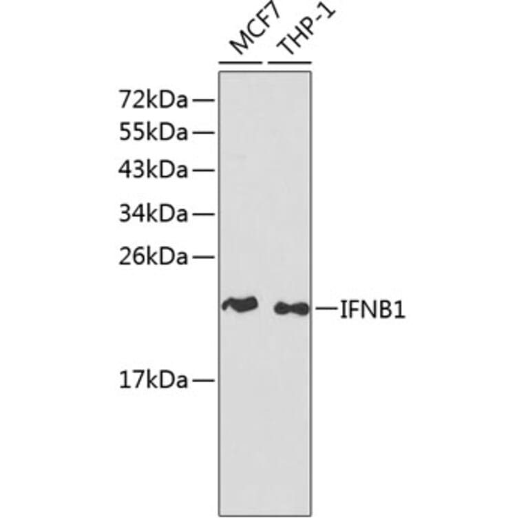Western Blot - Anti-IFNB1 Antibody (A1575) - Antibodies.com