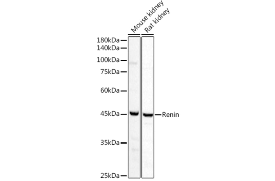 Western Blot - Anti-Renin Antibody (A8943) - Antibodies.com