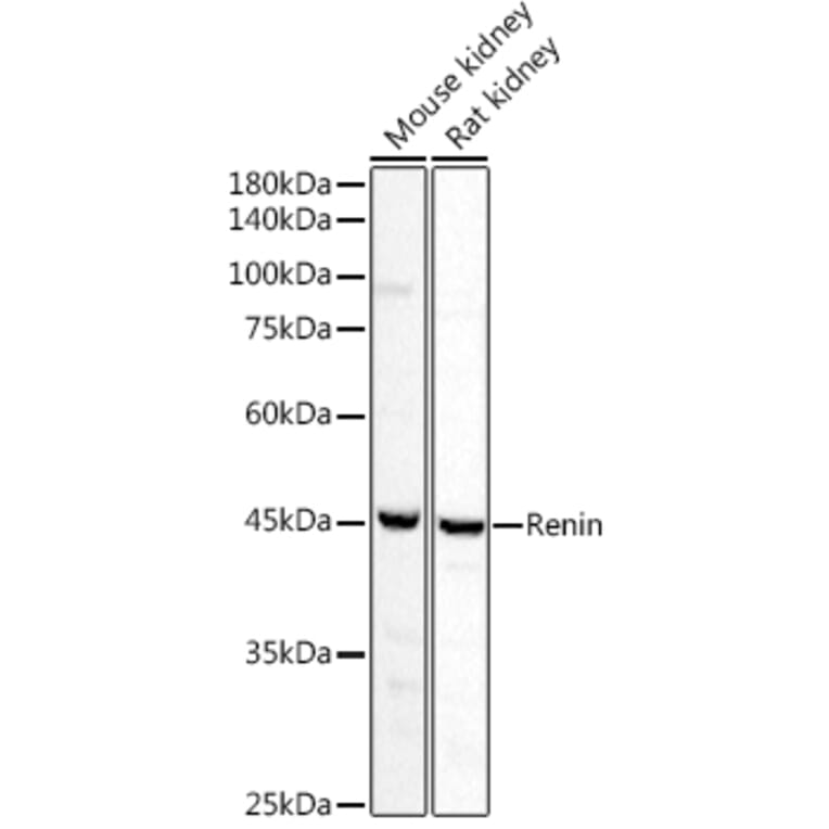 Western Blot - Anti-Renin Antibody (A8943) - Antibodies.com