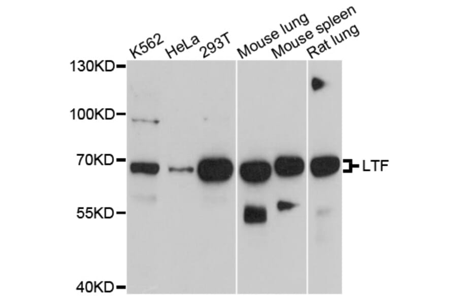 Western Blot - Anti-LTF Antibody (A1597) - Antibodies.com