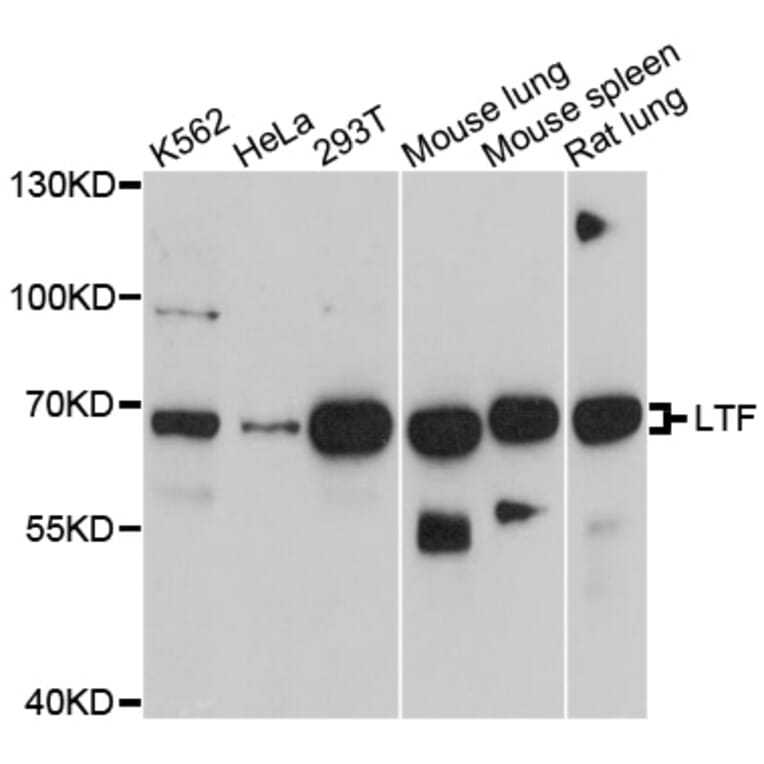 Western Blot - Anti-LTF Antibody (A1597) - Antibodies.com