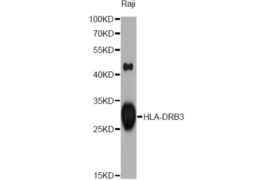 Western Blot - Anti-HLA-DRB3 Antibody (A1611) - Antibodies.com