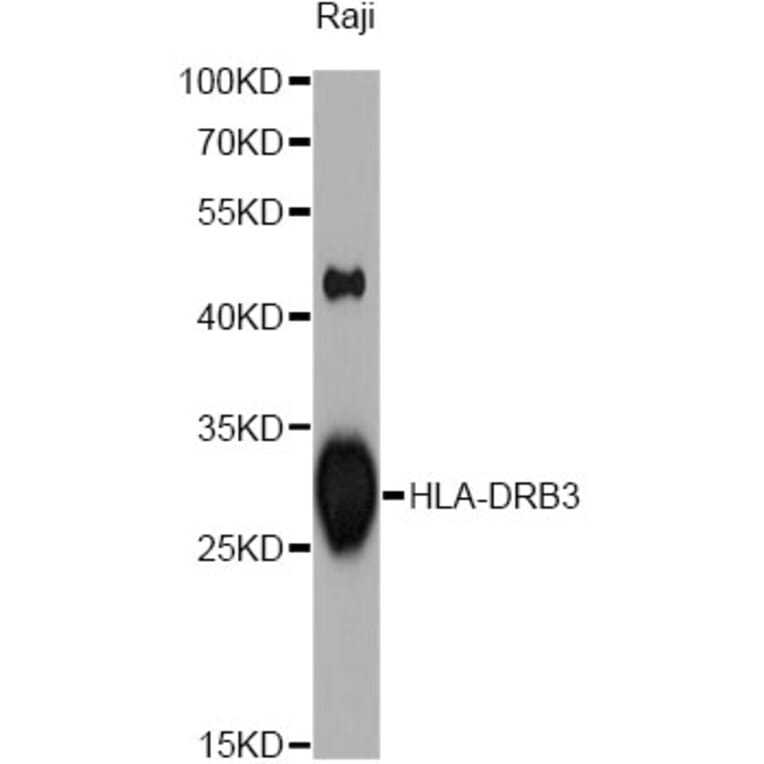 Western Blot - Anti-HLA-DRB3 Antibody (A1611) - Antibodies.com