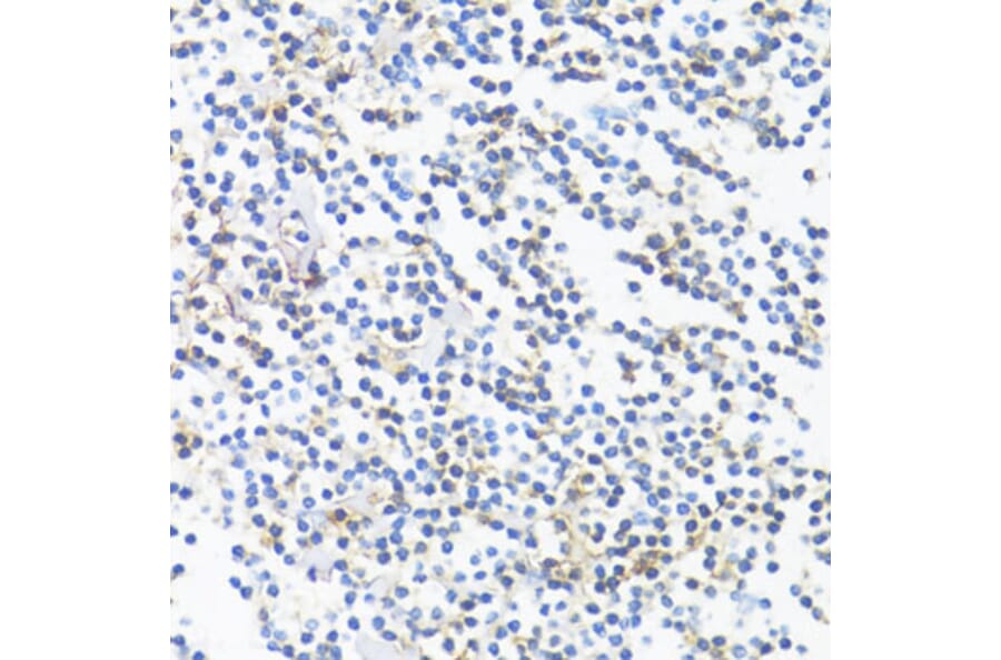 Immunohistochemistry - Anti-HLA-DRB3 Antibody (A1611) - Antibodies.com