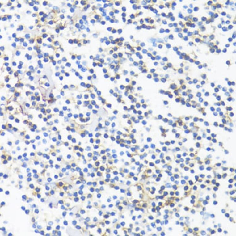 Immunohistochemistry - Anti-HLA-DRB3 Antibody (A1611) - Antibodies.com