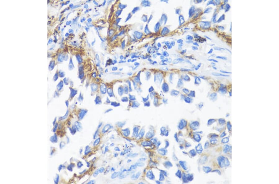Immunohistochemistry - Anti-HLA-DRB3 Antibody (A1611) - Antibodies.com