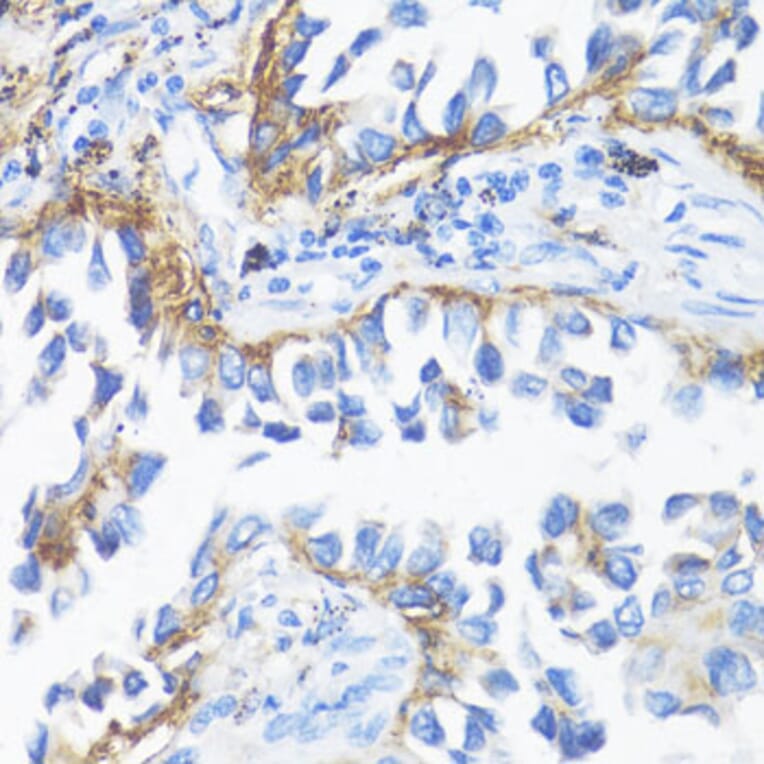 Immunohistochemistry - Anti-HLA-DRB3 Antibody (A1611) - Antibodies.com