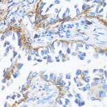 Immunohistochemistry - Anti-HLA-DRB3 Antibody (A1611) - Antibodies.com