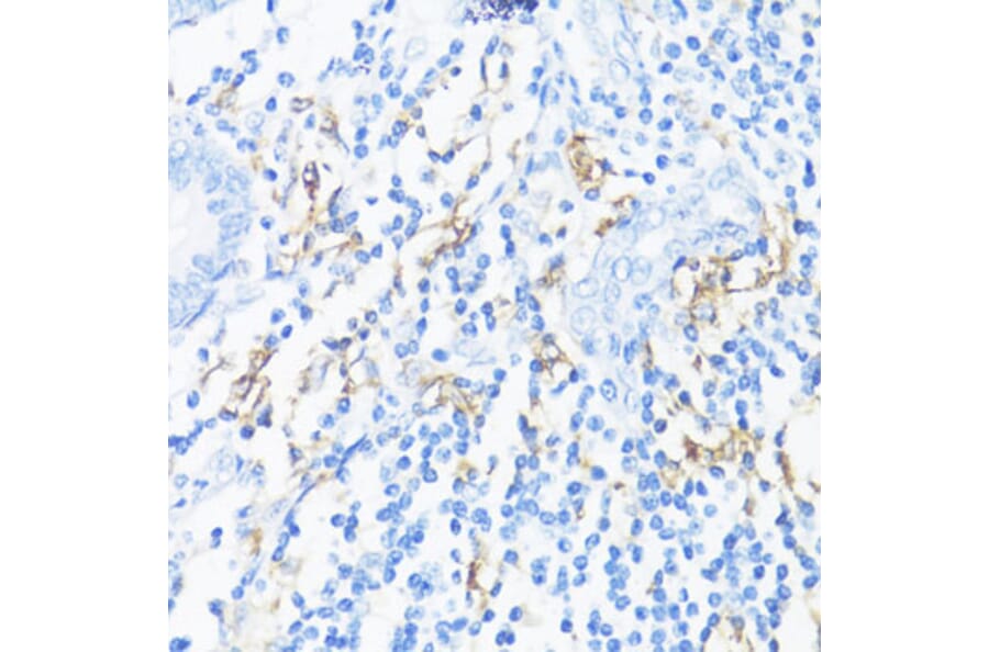 Immunohistochemistry - Anti-HLA-DRB3 Antibody (A1611) - Antibodies.com