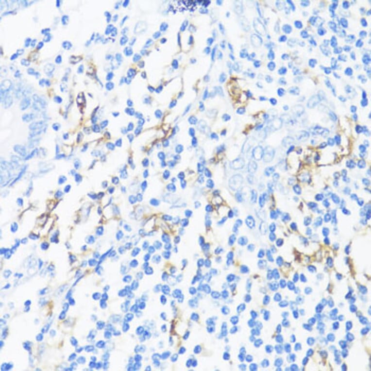 Immunohistochemistry - Anti-HLA-DRB3 Antibody (A1611) - Antibodies.com