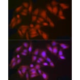 Immunofluorescence - Anti-Indoleamine 2, 3-dioxygenase Antibody (A8946) - Antibodies.com