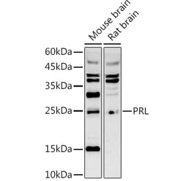 Western Blot - Anti-Prolactin Antibody (A8947) - Antibodies.com