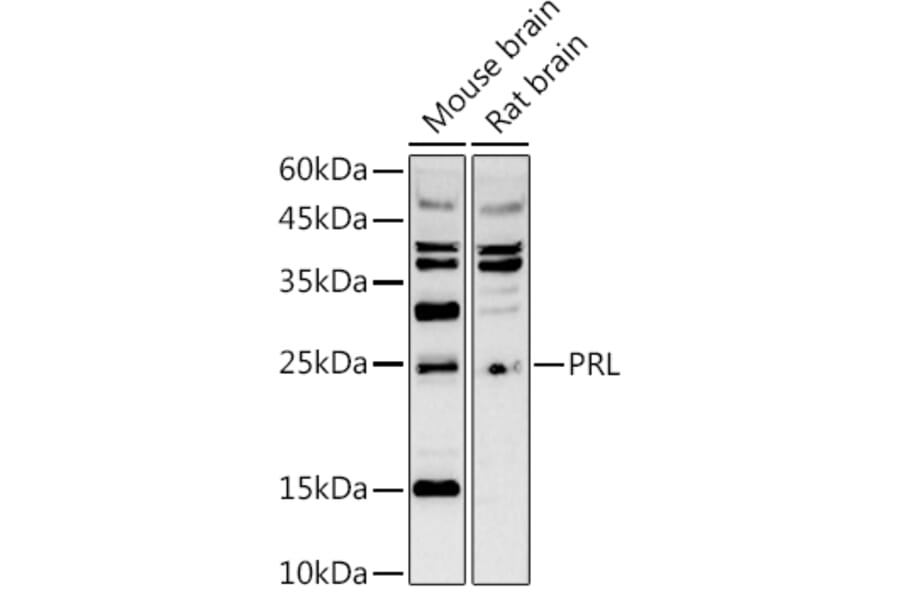Western Blot - Anti-Prolactin Antibody (A8947) - Antibodies.com