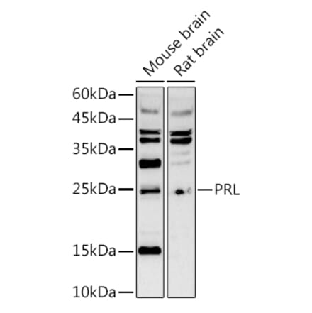 Western Blot - Anti-Prolactin Antibody (A8947) - Antibodies.com