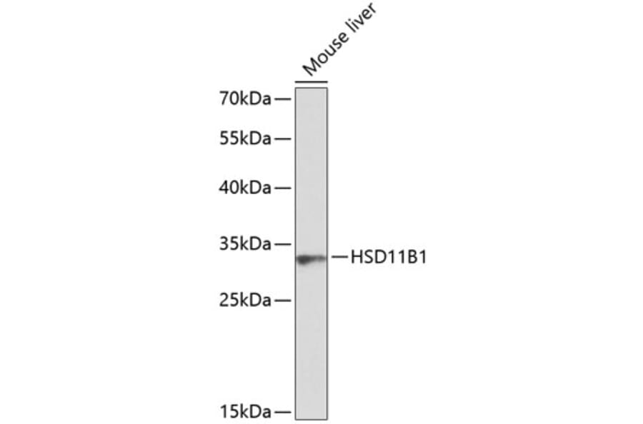 Western Blot - Anti-HSD11B1 Antibody (A8948) - Antibodies.com