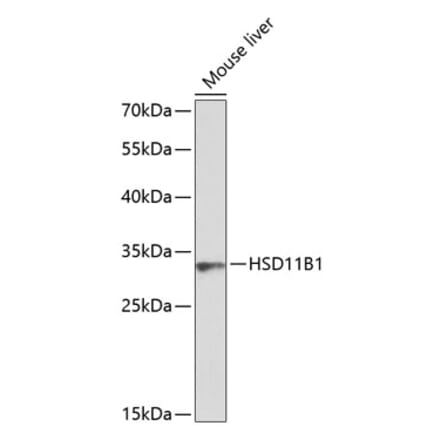 Western Blot - Anti-HSD11B1 Antibody (A8948) - Antibodies.com