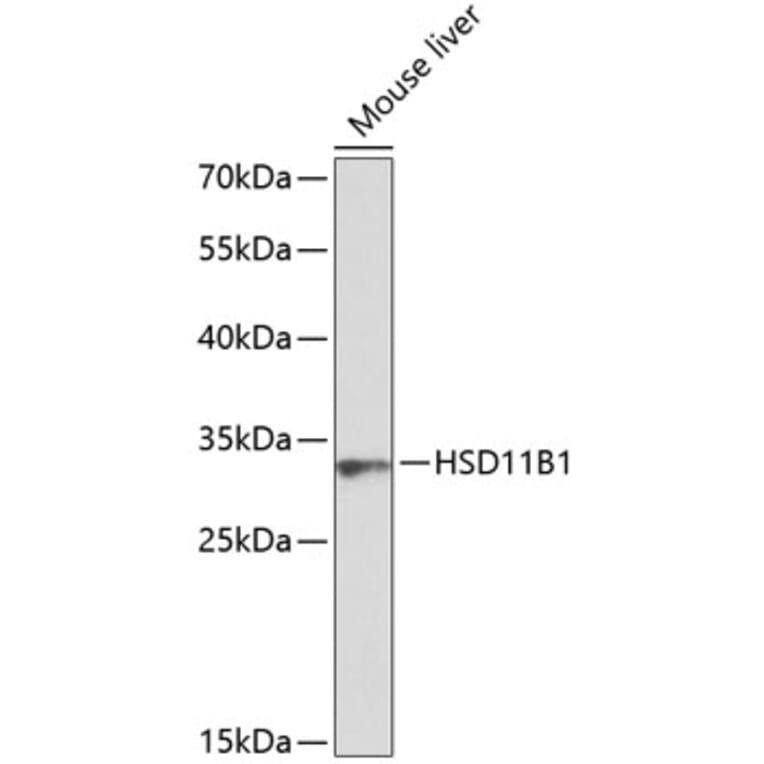 Western Blot - Anti-HSD11B1 Antibody (A8948) - Antibodies.com