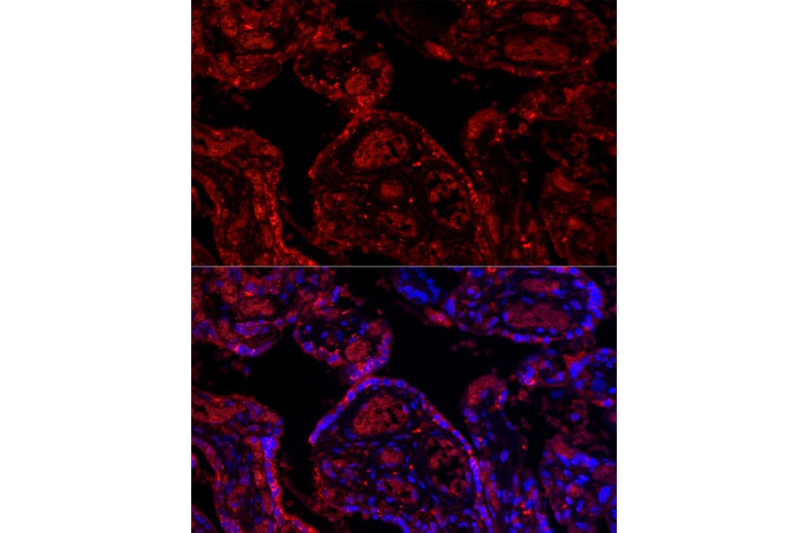 Immunofluorescence - Anti-PD-L1 Antibody (A8949) - Antibodies.com