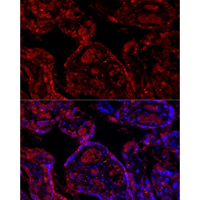 Immunofluorescence - Anti-PD-L1 Antibody (A8949) - Antibodies.com