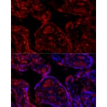 Immunofluorescence - Anti-PD-L1 Antibody (A8949) - Antibodies.com