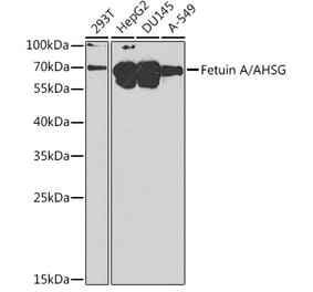 Western Blot - Anti-AHSG Antibody (A8950) - Antibodies.com