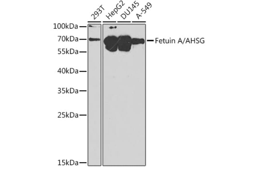 Western Blot - Anti-AHSG Antibody (A8950) - Antibodies.com