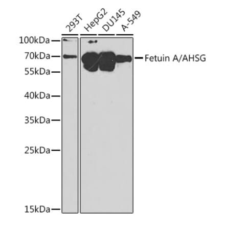 Western Blot - Anti-AHSG Antibody (A8950) - Antibodies.com