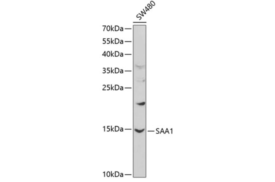 Western Blot - Anti-Serum Amyloid A Antibody (A8951) - Antibodies.com