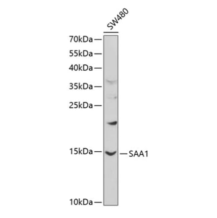 Western Blot - Anti-Serum Amyloid A Antibody (A8951) - Antibodies.com