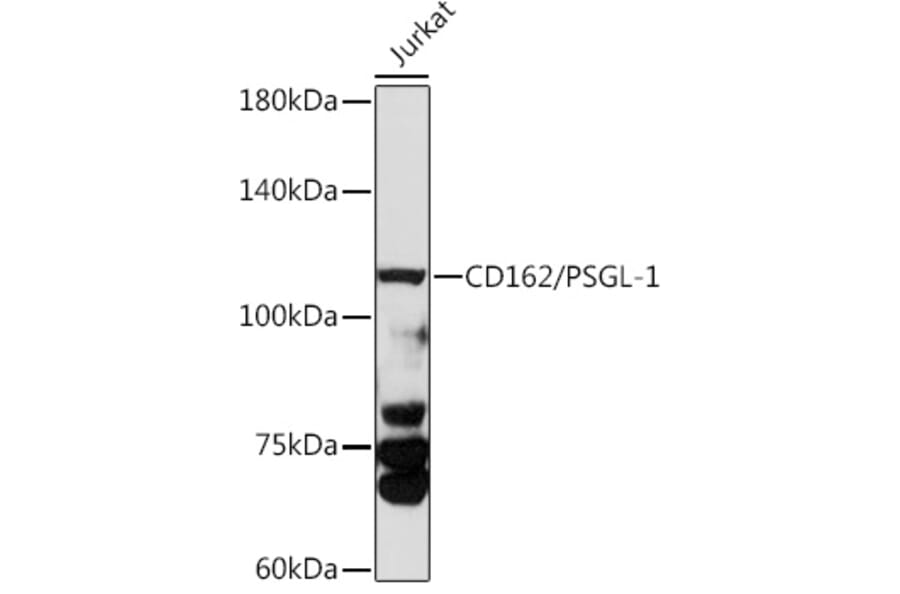 Western Blot - Anti-PSGL-1 Antibody (A8952) - Antibodies.com