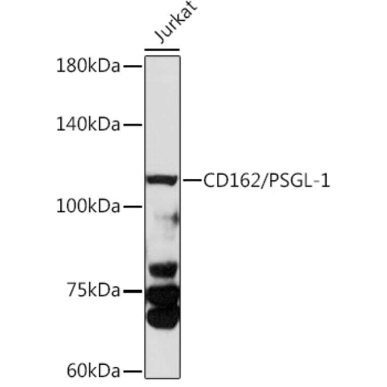 Western Blot - Anti-PSGL-1 Antibody (A8952) - Antibodies.com
