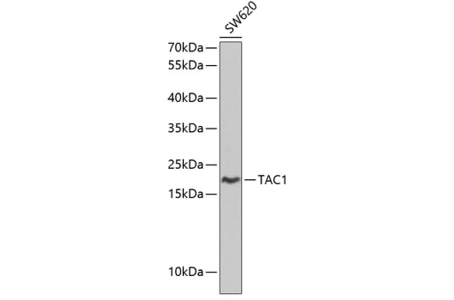Western Blot - Anti-Substance P Antibody (A8953) - Antibodies.com