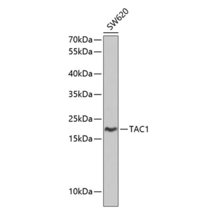 Western Blot - Anti-Substance P Antibody (A8953) - Antibodies.com