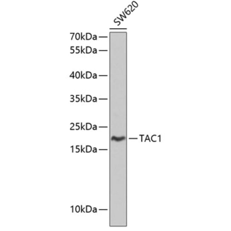 Western Blot - Anti-Substance P Antibody (A8953) - Antibodies.com