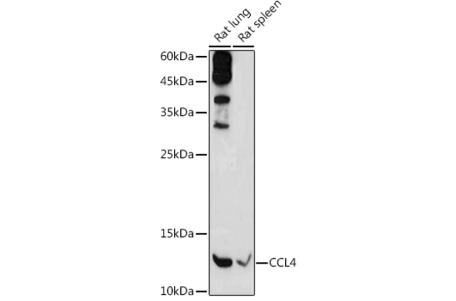 Western Blot - Anti-CCL4/MIP-1 beta Antibody (A8954) - Antibodies.com