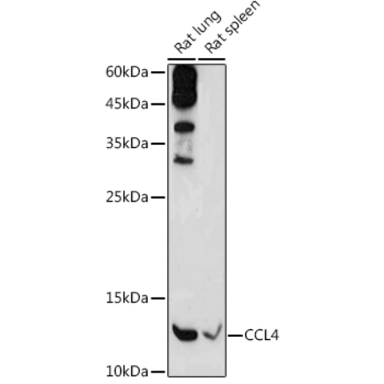 Western Blot - Anti-CCL4/MIP-1 beta Antibody (A8954) - Antibodies.com