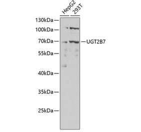 Western Blot - Anti-UGT2B7 Antibody (A8955) - Antibodies.com