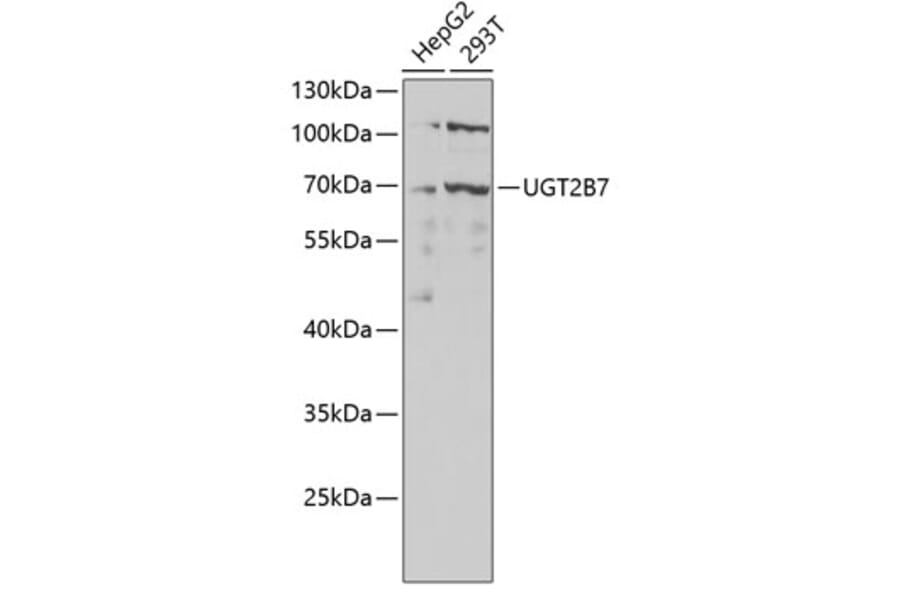 Western Blot - Anti-UGT2B7 Antibody (A8955) - Antibodies.com