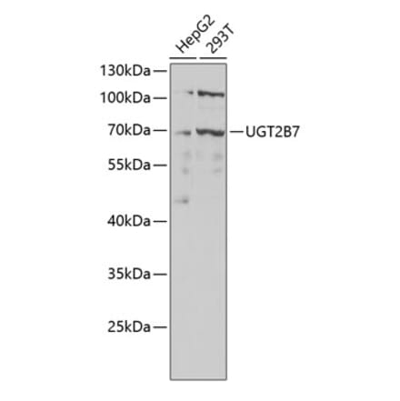 Western Blot - Anti-UGT2B7 Antibody (A8955) - Antibodies.com