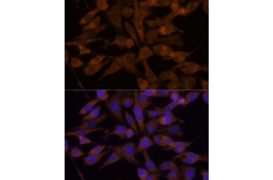 Immunofluorescence - Anti-UGT2B7 Antibody (A8955) - Antibodies.com