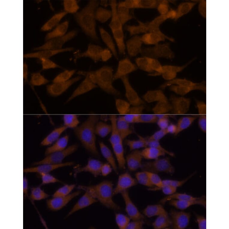 Immunofluorescence - Anti-UGT2B7 Antibody (A8955) - Antibodies.com