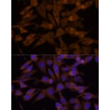 Immunofluorescence - Anti-UGT2B7 Antibody (A8955) - Antibodies.com